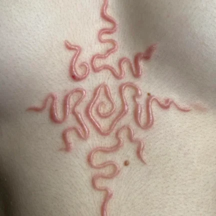 scar-update-1-month-into-healing-still-getting-more-v0-bruhk2pargda1